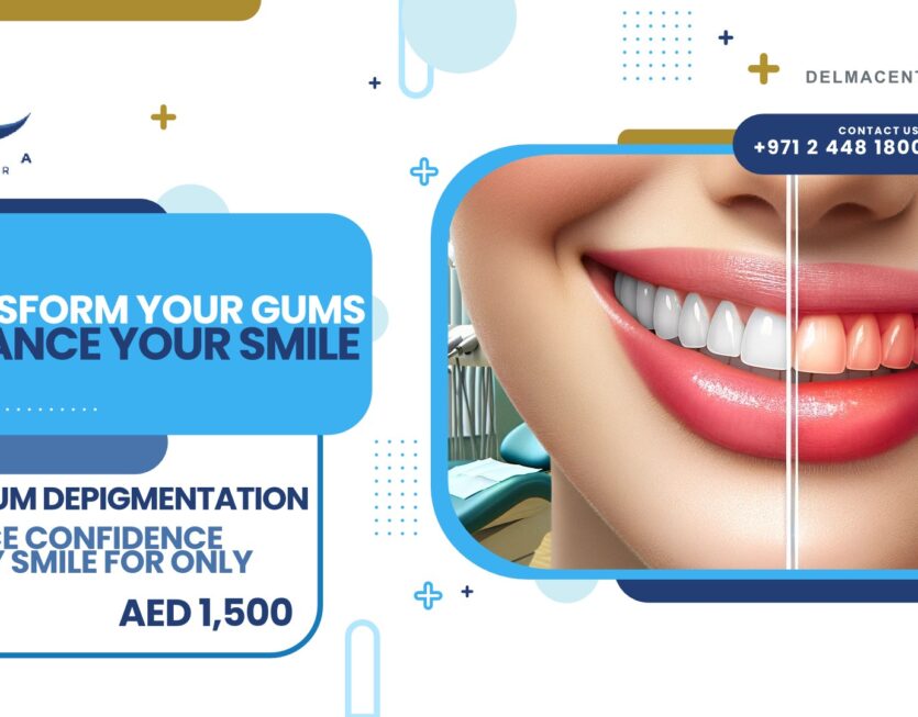 02 Laser Gum Depigmentation